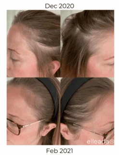 Hair Strengthening Serum - All Natural, Vegan, Hair Loss, Dry/Itchy Scalp 38 Hair Strengthening Serum - All Natural, Vegan, Hair Loss, Dry/Itchy Scalp -Zero Waste Store elleada hair strengthening serum all natural vegan hair loss dry itchy scalp 1173564888