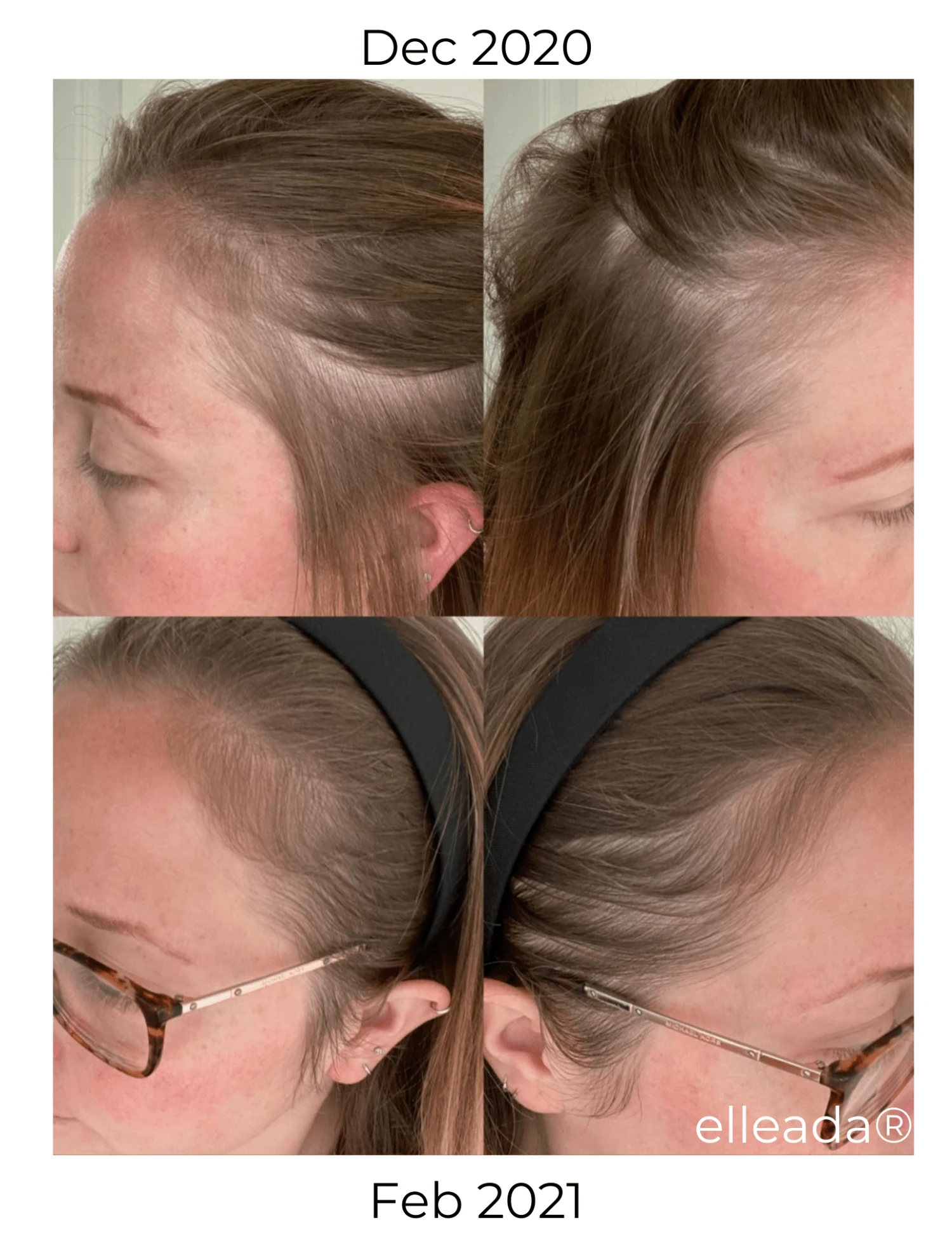 Hair Strengthening Serum - All Natural, Vegan, Hair Loss, Dry/Itchy Scalp 19 Hair Strengthening Serum - All Natural, Vegan, Hair Loss, Dry/Itchy Scalp - Image 19