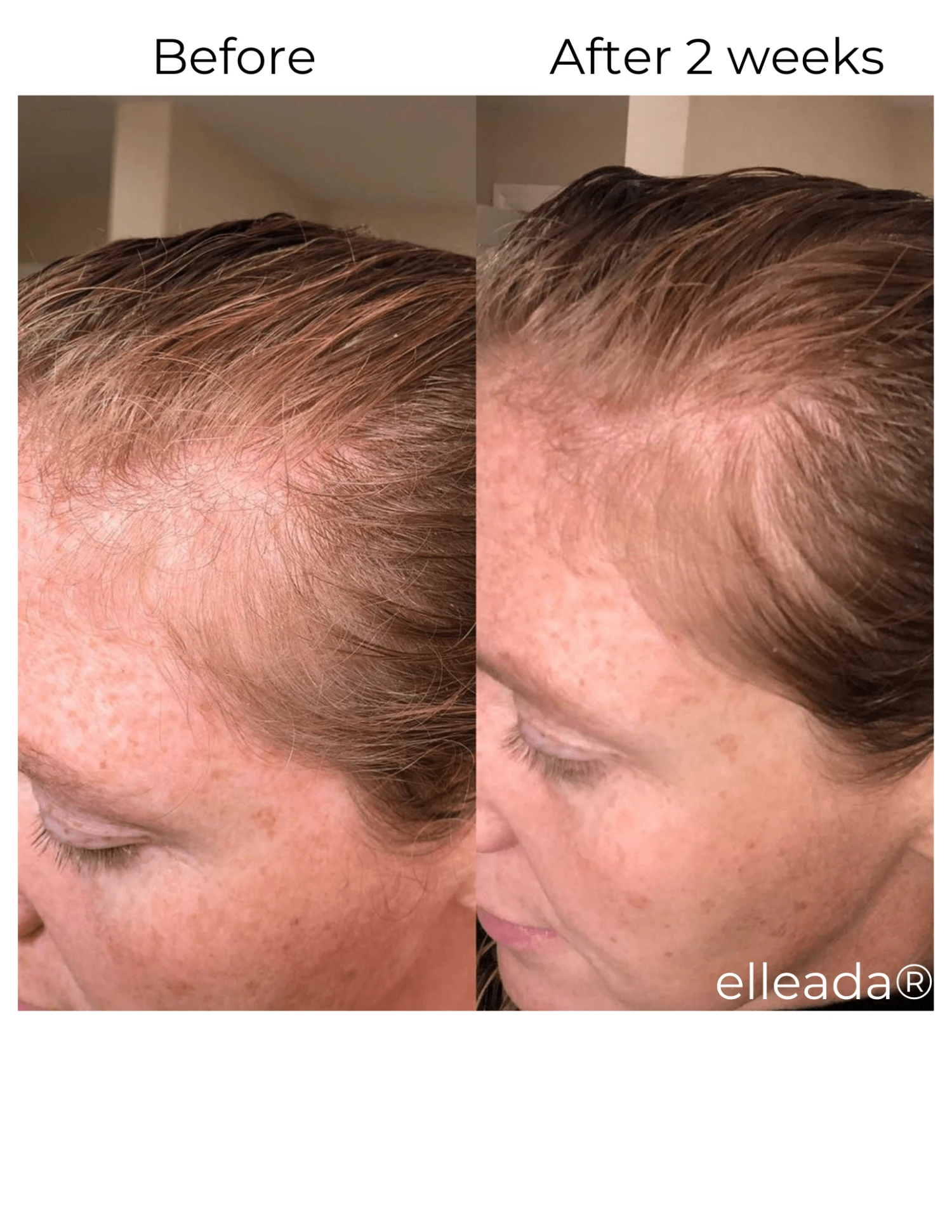 Hair Strengthening Serum - All Natural, Vegan, Hair Loss, Dry/Itchy Scalp 15 Hair Strengthening Serum - All Natural, Vegan, Hair Loss, Dry/Itchy Scalp - Image 15