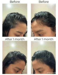 Hair Strengthening Serum - All Natural, Vegan, Hair Loss, Dry/Itchy Scalp 37 Hair Strengthening Serum - All Natural, Vegan, Hair Loss, Dry/Itchy Scalp -Zero Waste Store elleada hair strengthening serum all natural vegan hair loss dry itchy scalp 1173564890