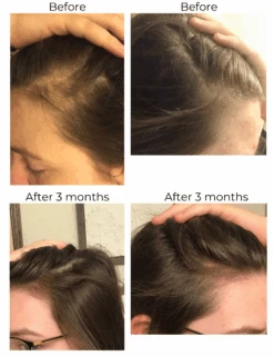 Hair Strengthening Serum - All Natural, Vegan, Hair Loss, Dry/Itchy Scalp 35 Hair Strengthening Serum - All Natural, Vegan, Hair Loss, Dry/Itchy Scalp -Zero Waste Store elleada hair strengthening serum all natural vegan hair loss dry itchy scalp 1173564891