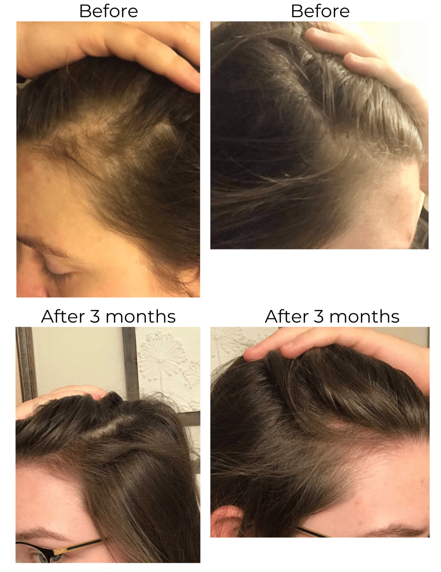 Hair Strengthening Serum - All Natural, Vegan, Hair Loss, Dry/Itchy Scalp 16 Hair Strengthening Serum - All Natural, Vegan, Hair Loss, Dry/Itchy Scalp - Image 16