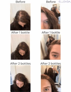 Hair Strengthening Serum - All Natural, Vegan, Hair Loss, Dry/Itchy Scalp 33 Hair Strengthening Serum - All Natural, Vegan, Hair Loss, Dry/Itchy Scalp -Zero Waste Store elleada hair strengthening serum all natural vegan hair loss dry itchy scalp 1173564895