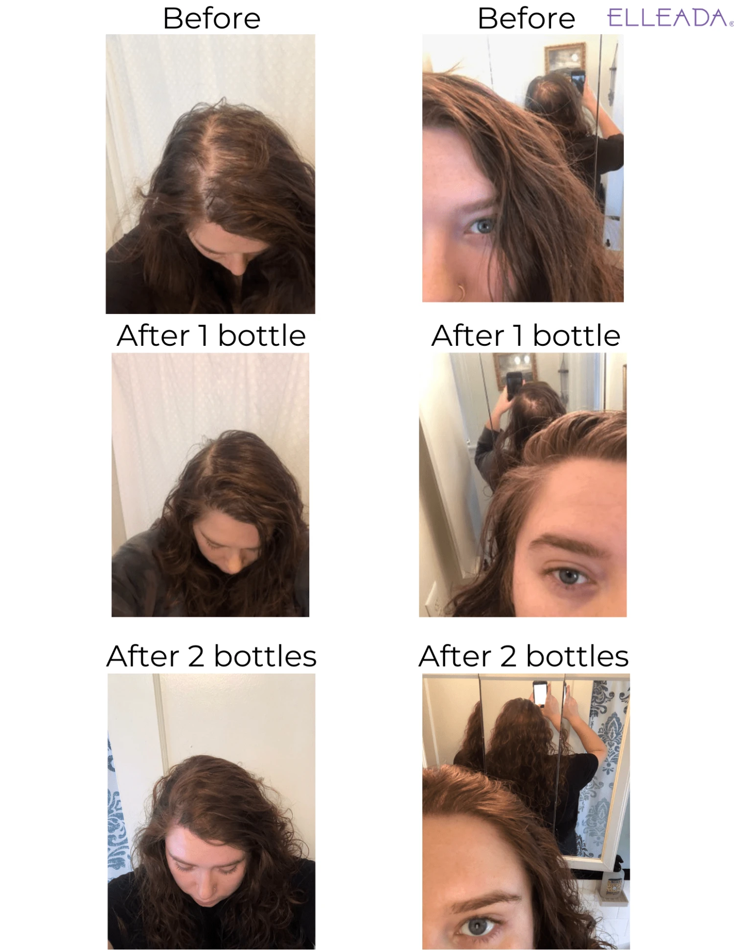 Hair Strengthening Serum - All Natural, Vegan, Hair Loss, Dry/Itchy Scalp 14 Hair Strengthening Serum - All Natural, Vegan, Hair Loss, Dry/Itchy Scalp - Image 14