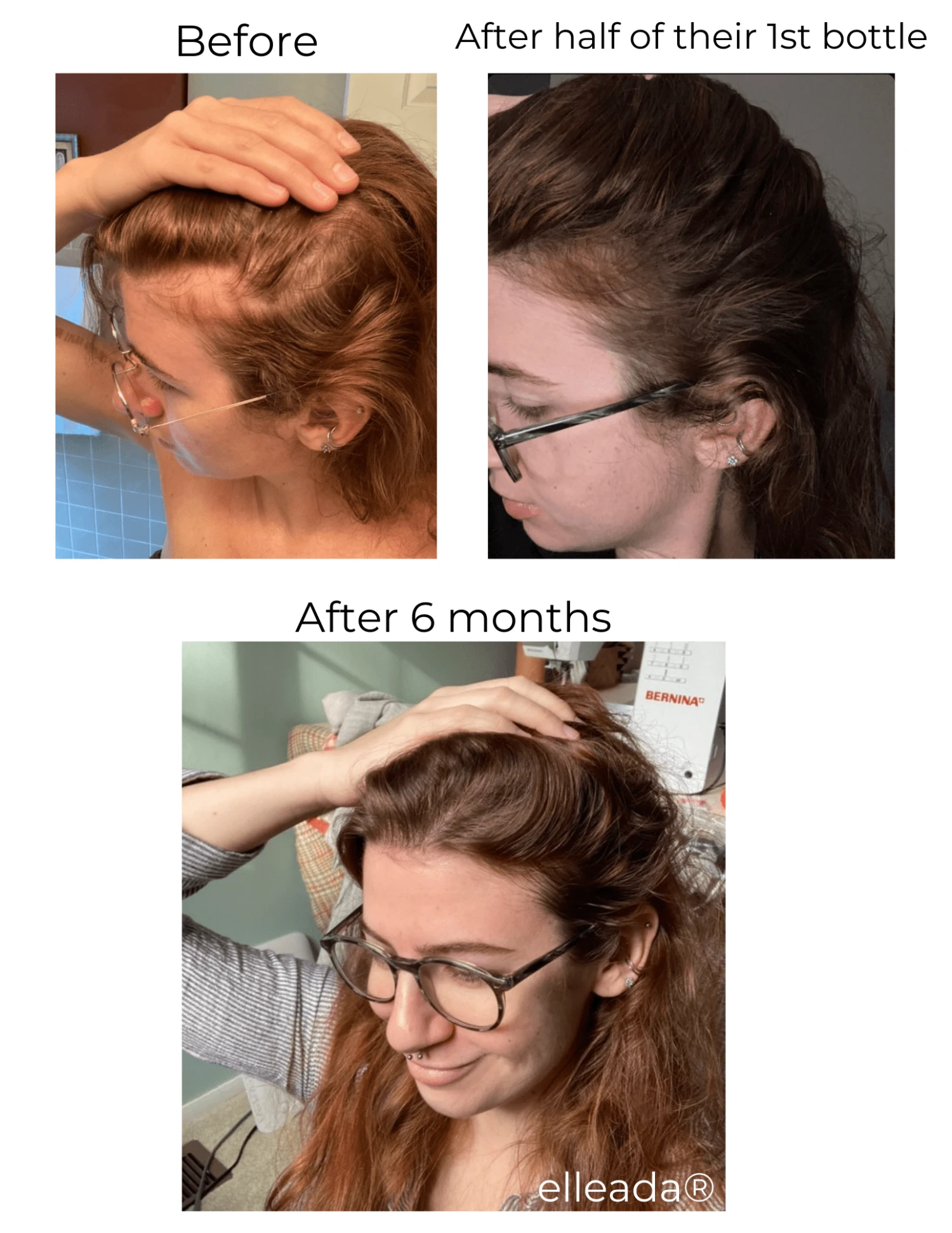 Hair Strengthening Serum - All Natural, Vegan, Hair Loss, Dry/Itchy Scalp 9 Hair Strengthening Serum - All Natural, Vegan, Hair Loss, Dry/Itchy Scalp - Image 9