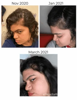 Hair Strengthening Serum - All Natural, Vegan, Hair Loss, Dry/Itchy Scalp 36 Hair Strengthening Serum - All Natural, Vegan, Hair Loss, Dry/Itchy Scalp -Zero Waste Store elleada hair strengthening serum all natural vegan hair loss dry itchy scalp 1173564897