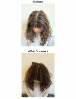 Hair Strengthening Serum - All Natural, Vegan, Hair Loss, Dry/Itchy Scalp 32 Hair Strengthening Serum - All Natural, Vegan, Hair Loss, Dry/Itchy Scalp -Zero Waste Store elleada hair strengthening serum all natural vegan hair loss dry itchy scalp 1173564900