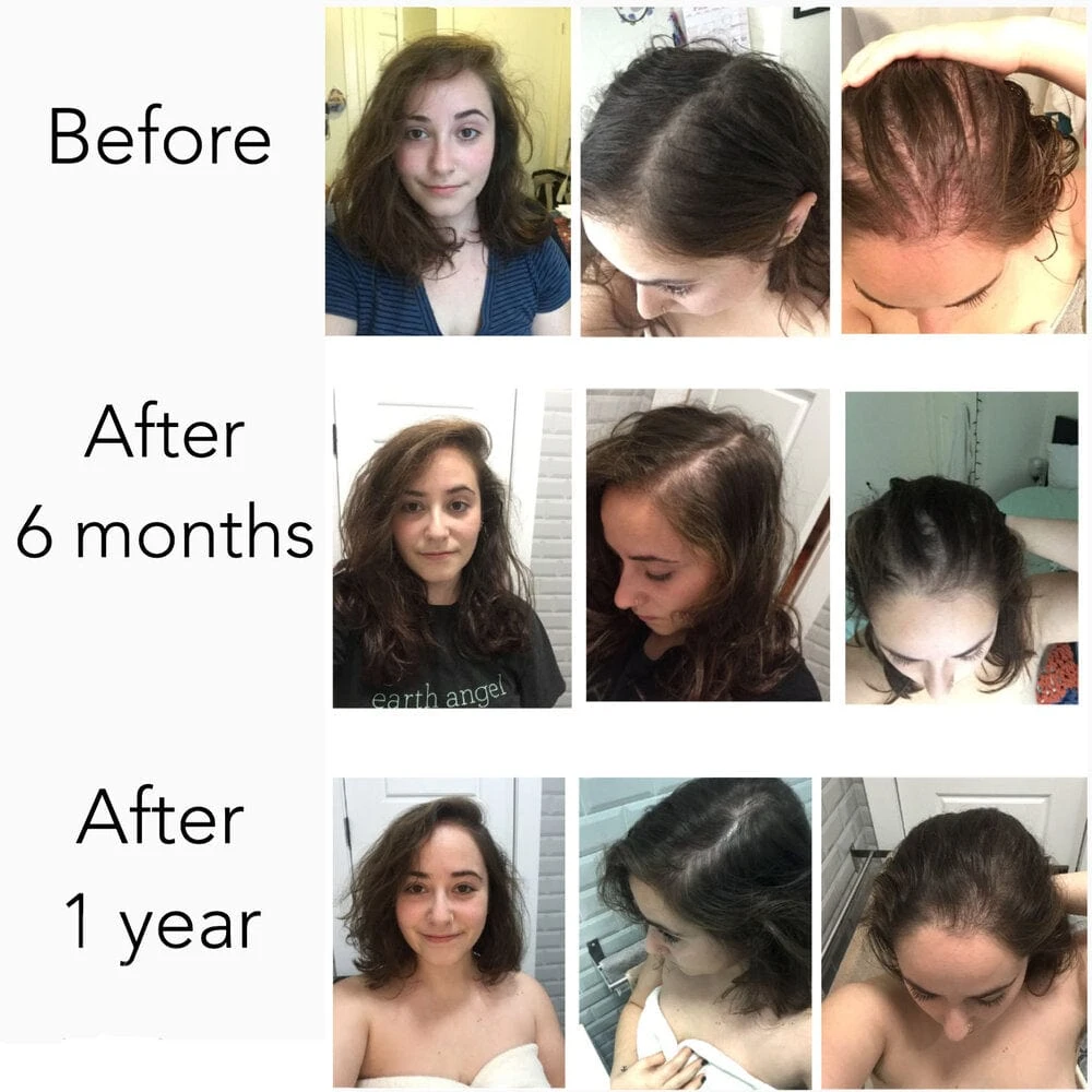 Hair Strengthening Serum - All Natural, Vegan, Hair Loss, Dry/Itchy Scalp 7 Hair Strengthening Serum - All Natural, Vegan, Hair Loss, Dry/Itchy Scalp - Image 7