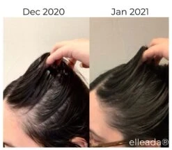 Hair Strengthening Serum - All Natural, Vegan, Hair Loss, Dry/Itchy Scalp 30 Hair Strengthening Serum - All Natural, Vegan, Hair Loss, Dry/Itchy Scalp -Zero Waste Store elleada hair strengthening serum all natural vegan hair loss dry itchy scalp 1173564909