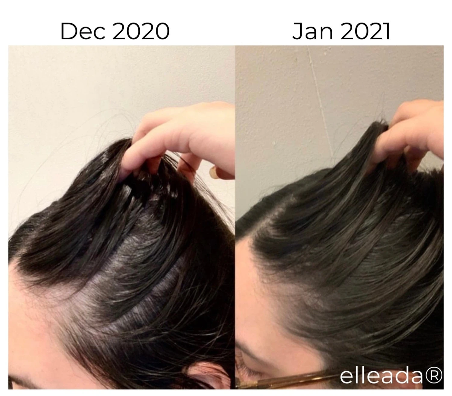 Hair Strengthening Serum - All Natural, Vegan, Hair Loss, Dry/Itchy Scalp 11 Hair Strengthening Serum - All Natural, Vegan, Hair Loss, Dry/Itchy Scalp - Image 11