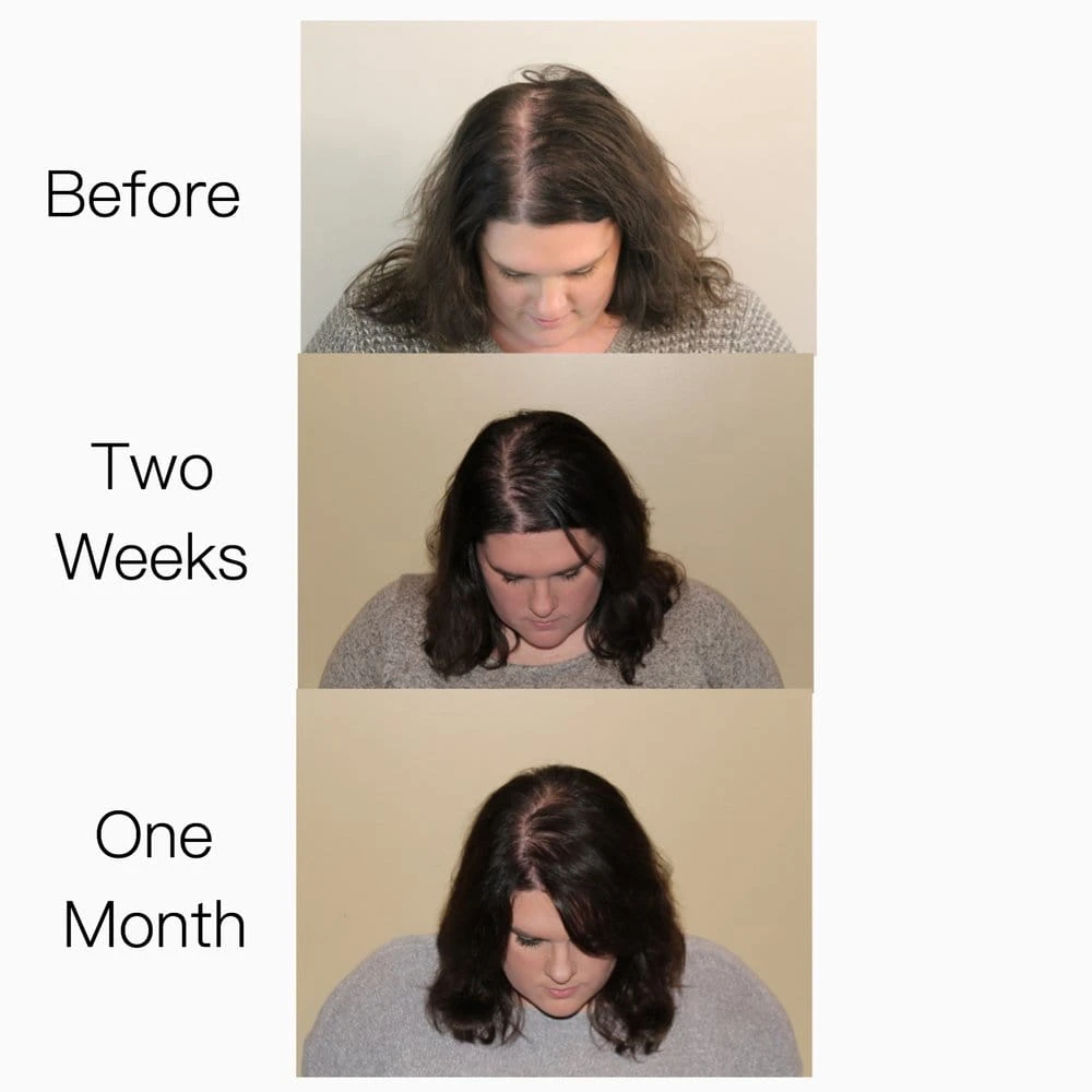 Hair Strengthening Serum - All Natural, Vegan, Hair Loss, Dry/Itchy Scalp 2 Hair Strengthening Serum - All Natural, Vegan, Hair Loss, Dry/Itchy Scalp - Image 2