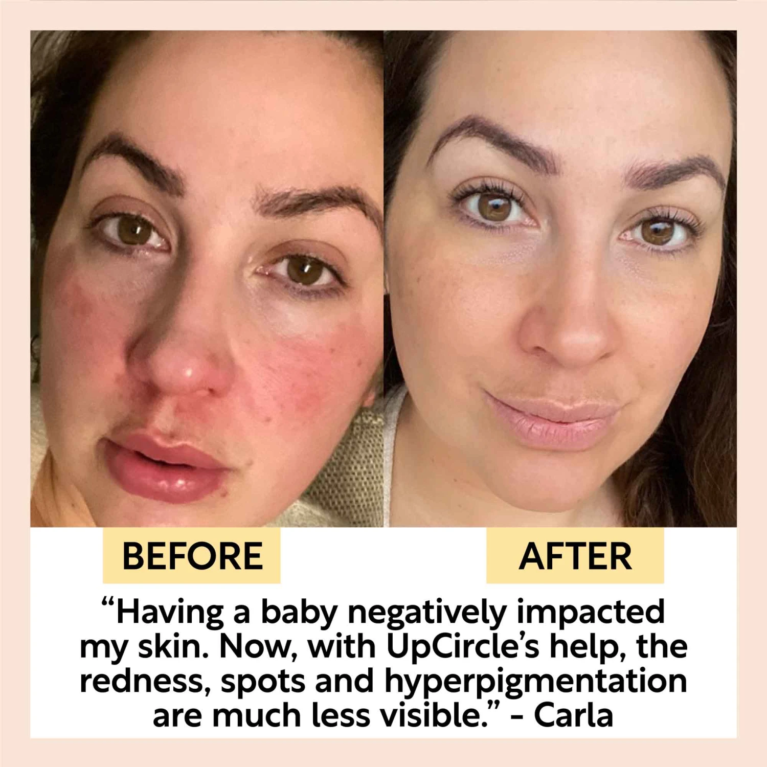 Day + Night Hydration Set 9 Day + Night Hydration Set - Image 9