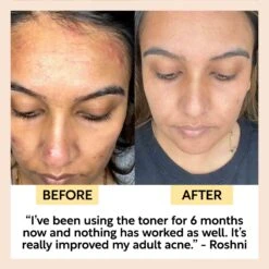 Face Toner -Zero Waste Store upcircle beauty face toner 59478040019313