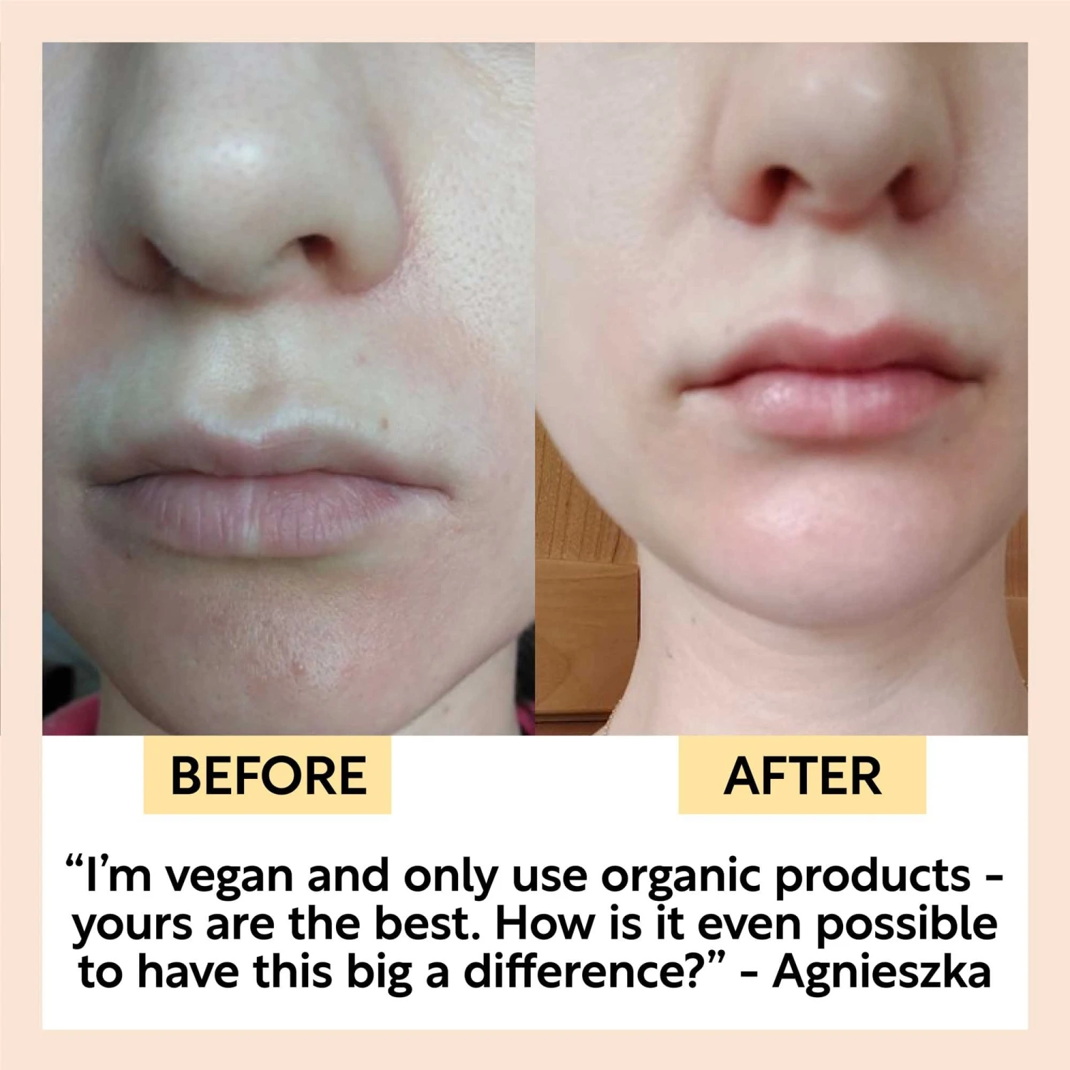 Organic Face Oil With Coffee, Rosehip + Jojoba 7 Organic Face Oil With Coffee, Rosehip + Jojoba - Image 7